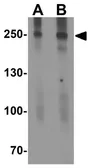 Anti-C2CD3 antibody used in Western Blot (WB). GTX32156