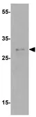 Anti-ULBP4 antibody used in Western Blot (WB). GTX32159