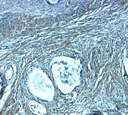 Anti-PMEPA1 antibody used in IHC (Paraffin sections) (IHC-P). GTX32162