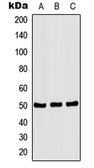 Anti-CSK (phospho Ser364) antibody used in Western Blot (WB). GTX32169