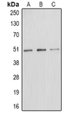 Anti-E2F1 (phospho Thr433) antibody used in Western Blot (WB). GTX32172