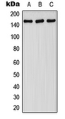 Anti-FANCA (phospho Ser1149) antibody used in Western Blot (WB). GTX32179