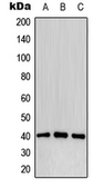 Anti-CD32B (phospho Tyr292) antibody used in Western Blot (WB). GTX32180