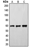 Anti-FYN (phospho Tyr530) antibody used in Western Blot (WB). GTX32185