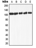 Anti-GAB1 (phospho Tyr659) antibody used in Western Blot (WB). GTX32186