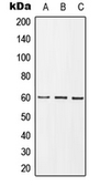 Anti-GRB10 (phospho Tyr67) antibody used in Western Blot (WB). GTX32187