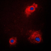 Anti-GSK3 alpha (phospho Ser21) antibody used in Immunocytochemistry/ Immunofluorescence (ICC/IF). GTX32191