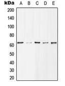 Anti-HDAC1 (phospho Ser421) antibody used in Western Blot (WB). GTX32193