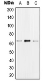 Anti-hnRNP K (phospho Ser284) antibody used in Western Blot (WB). GTX32194