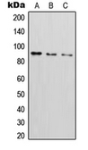 Anti-ICAM1 / CD54 (phospho Tyr512) antibody used in Western Blot (WB). GTX32196