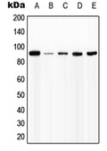 Anti-Interferon gamma Receptor 1 (phospho Tyr457) antibody used in Western Blot (WB). GTX32197
