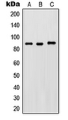 Anti-IKK beta (phospho Tyr188) antibody used in Western Blot (WB). GTX32199