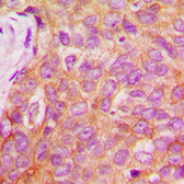 Anti-IRS1 (phospho Ser1101) antibody used in IHC (Paraffin sections) (IHC-P). GTX32201