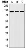 Anti-JAK2 (phospho Tyr1007) antibody used in Western Blot (WB). GTX32203
