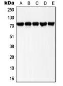 Anti-LIMK1 (phospho Thr508) + LIMK2 (phospho Thr505) antibody used in Western Blot (WB). GTX32211