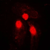 Anti-SMAD3 (phospho Ser204) antibody used in Immunocytochemistry/ Immunofluorescence (ICC/IF). GTX32214
