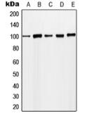 Anti-MCM4 (phospho Ser54) antibody used in Western Blot (WB). GTX32215