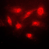 Anti-IKB beta (phospho Ser23) antibody used in Immunocytochemistry/ Immunofluorescence (ICC/IF). GTX32225