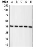 Anti-Nucleophosmin (phospho Thr234) antibody used in Western Blot (WB). GTX32229