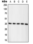 Anti-Nucleophosmin (phospho Thr234) antibody used in Western Blot (WB). GTX32229