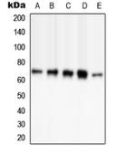 Anti-PAK3 (phospho Ser154) antibody used in Western Blot (WB). GTX32232