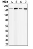Anti-PLCB3 (phospho Ser537) antibody used in Western Blot (WB). GTX32237