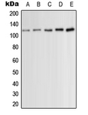 Anti-PKC mu (phospho Ser910) antibody used in Western Blot (WB). GTX32245