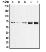 Anti-PKC zeta (phospho Thr560) antibody used in Western Blot (WB). GTX32247