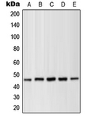 Anti-MEK1 (phospho Thr286) antibody used in Western Blot (WB). GTX32248