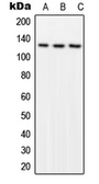 Anti-FAK (phospho Tyr576) antibody used in Western Blot (WB). GTX32250