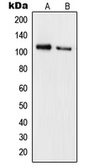 Anti-Rb (phospho Ser780) antibody used in Western Blot (WB). GTX32254