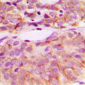 Anti-Src (phospho Tyr530) antibody used in IHC (Paraffin sections) (IHC-P). GTX32265