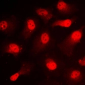 Anti-STAT1 (phospho Ser727) antibody used in Immunocytochemistry/ Immunofluorescence (ICC/IF). GTX32266