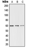 Anti-TRF1 (phospho Ser219) antibody used in Western Blot (WB). GTX32274