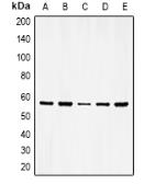 Anti-Vimentin (phospho Ser56) antibody used in Western Blot (WB). GTX32278