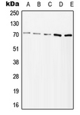 Anti-ZAP70 (phospho Tyr315) antibody used in Western Blot (WB). GTX32280
