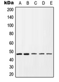 Anti-CXCR4 (phospho Ser339) antibody used in Western Blot (WB). GTX32281