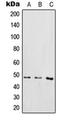 Anti-IKK gamma (phospho Ser85) antibody used in Western Blot (WB). GTX32283