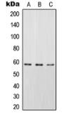 Anti-STAM2 (phospho Tyr192) antibody used in Western Blot (WB). GTX32284