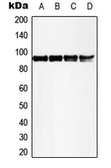 Anti-MSK1 (phospho Thr581) antibody used in Western Blot (WB). GTX32285