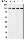Anti-p130Cas (phospho Tyr249) antibody used in Western Blot (WB). GTX32286