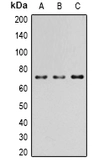 Anti-PAK4 (phospho Ser474) / PAK5 (phospho Ser602) / PAK6 (phospho Ser560) antibody used in Western Blot (WB). GTX32289