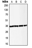 Anti-LAT (phospho Tyr191) antibody used in Western Blot (WB). GTX32291