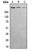 Anti-ATM (phospho Ser1981) antibody used in Western Blot (WB). GTX32295