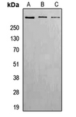 Anti-ATM (phospho Ser1981) antibody used in Western Blot (WB). GTX32295