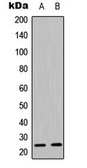 Anti-Caveolin 1 (phospho Tyr14) antibody used in Western Blot (WB). GTX32313
