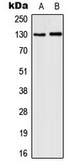 Anti-IL3 Receptor beta (phospho Tyr593) antibody used in Western Blot (WB). GTX32320