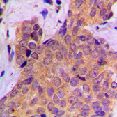 Anti-Cortactin (phospho Tyr421) antibody used in IHC (Paraffin sections) (IHC-P). GTX32325
