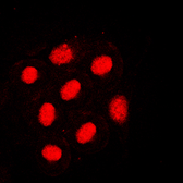 Anti-HNF4 alpha (phospho Ser313) antibody used in Immunocytochemistry/ Immunofluorescence (ICC/IF). GTX32329