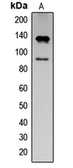 Anti-IFNAR1 (phospho Tyr466) antibody used in Western Blot (WB). GTX32330
